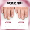 image:imageJODSONE Cuticle Oil for Damaged Skin And Thin Nails for Nail Growth Nourish and Condition Dry Nails with DropperWhite