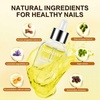 image:imageJODSONE Cuticle Oil for Damaged Skin And Thin Nails for Nail Growth Nourish and Condition Dry Nails with Dropperlight yellow
